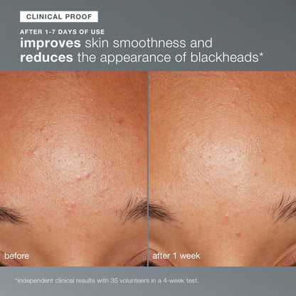 daily microfoliant exfoliator